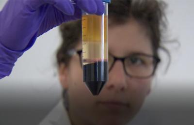 Buscando uma cura para o HIV: centro de pesquisa belga estuda recuperação viral