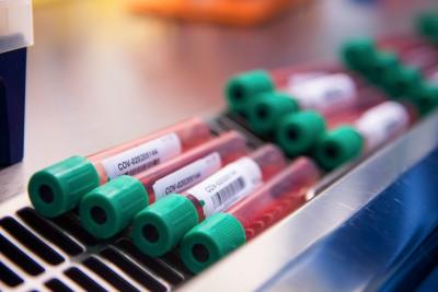 Covid-19: Unicef prepara estoque de 1 bilhão de seringas para futura vacina 