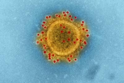 Coronavírus: MA tem mais de 170 mil casos confirmados 