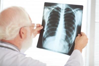 Pesquisa mostra aumento de mortes por  sindromes respiratórias graves