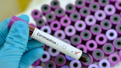 Sobe para 22 o número de casos do novo coronavírus no MA