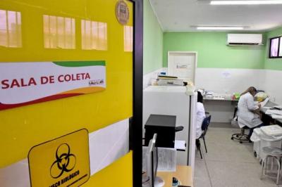  Autotestes de HIV são disponibilizados em São Luís