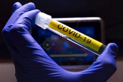 Coronavírus teste laboratório