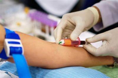Lei obriga laboratórios comunicarem SES sobre pacientes com alteração de hemoglobina glicada