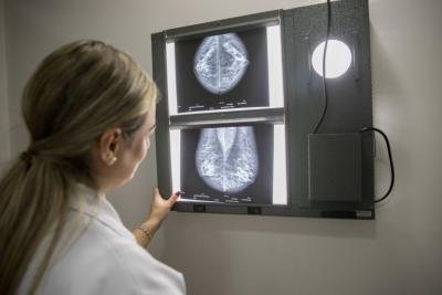 Isolamento na pandemia prejudicou diagnóstico de câncer de mama