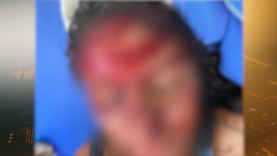 Mulher reage a tentativa de estupro e é esfaqueada no Maranhão