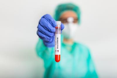 Fiocruz recebe registro para teste diagnóstico de varíola dos macacos