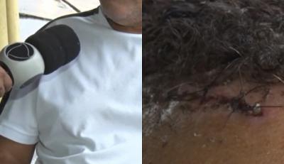 Motorista de ônibus é agredido com pedrada na cabeça em São Luís