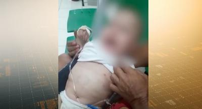 Polícia investiga caso de bebê vítima de tortura em Barra do Corda