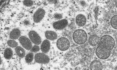 MA alinha monitoramento de casos suspeitos de 'varíola do macaco'