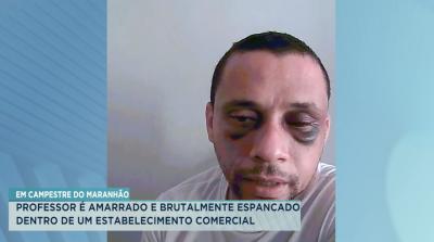 Campestre: polícia investiga agressões sofridas por professor