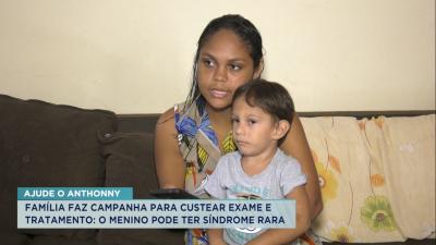 Família faz apelo por tratamento médico de criança com síndrome rara 