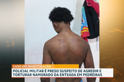 Polícia Civil investiga caso de jovem de 17 anos agredido por policial militar